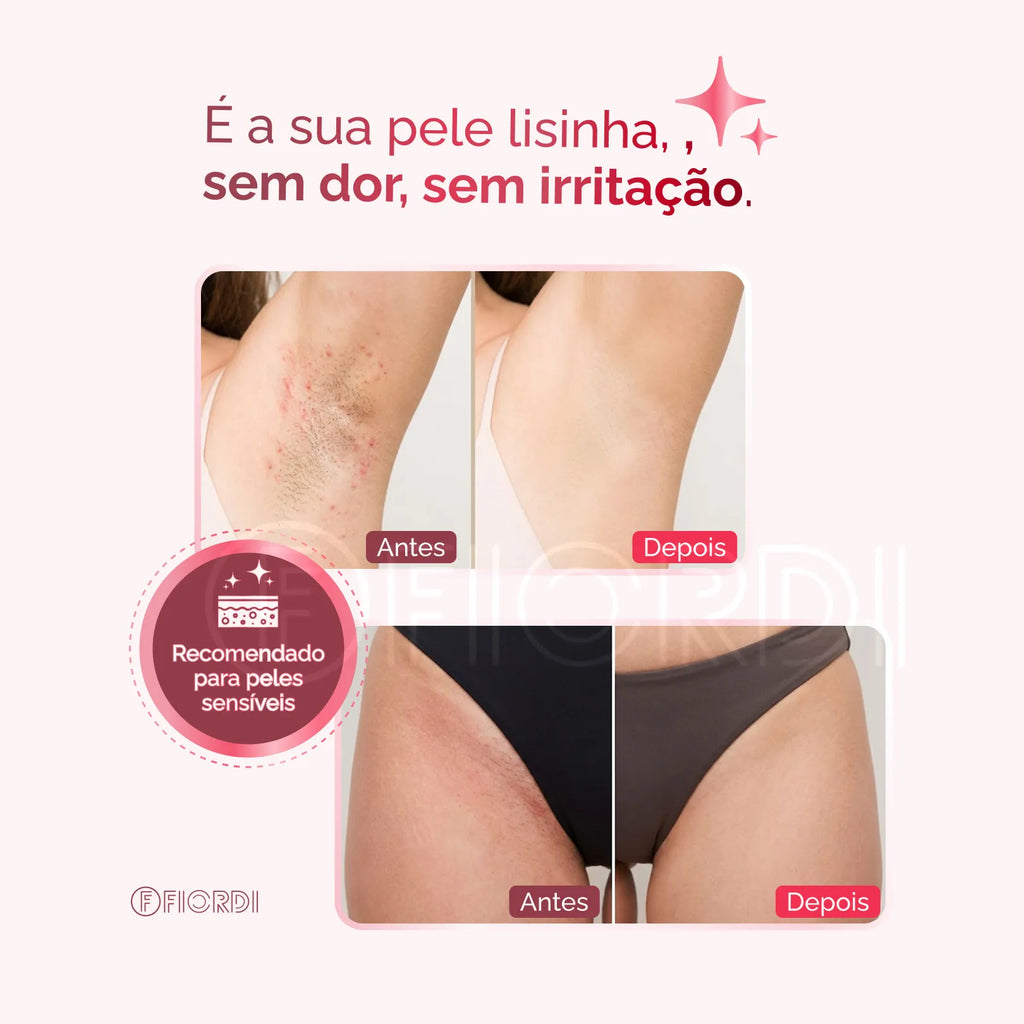 Depilador Elétrico 4 em 1 - SuavieFlex™